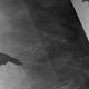 Will it or won’t it? New satellite photos show the iceberg’s latest movements.